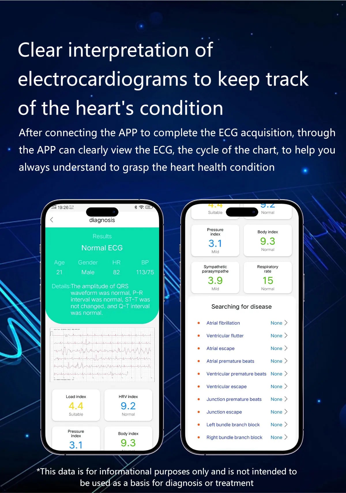 Smartwatch AMOLED Screen Call ECG Sport Watchs Air pump Measurement BP Micro physical examination AI dial Smart Watch Men Women