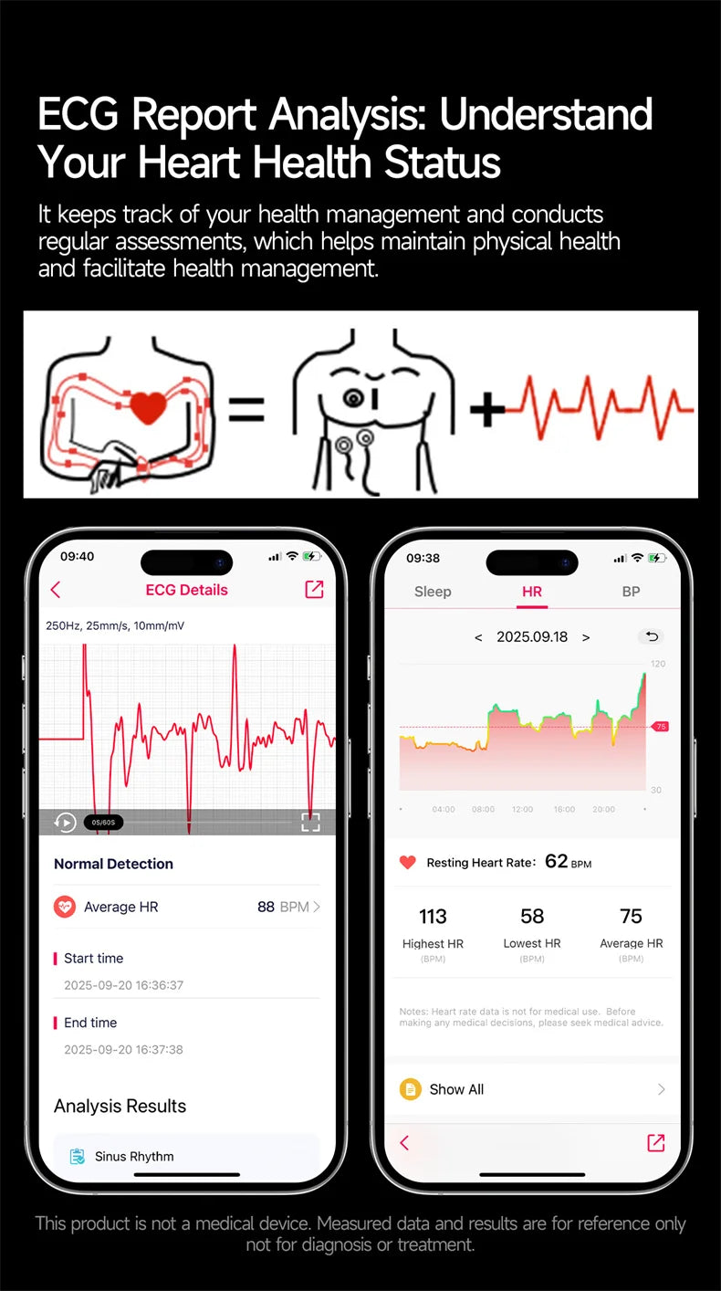 2026New Health Sport ECG AI Diagnosis Smart Watches Men Heart Rate Blood Pressure IP68 Waterproof Smartwatches For Men women